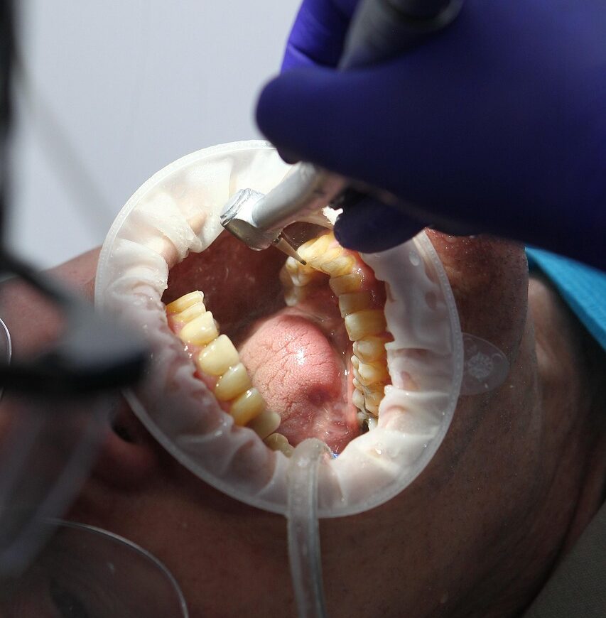 dentist, oral health, dental health, oral hygiene, dental hygiene, teeth, teeth cleaning, teeth whitening, dentist, dentist, dentist, dentist, dentist, oral health, dental health, teeth, teeth, teeth cleaning, teeth cleaning, teeth whitening, teeth whitening, teeth whitening