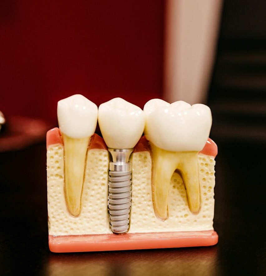 white and yellow wooden condiment shakers