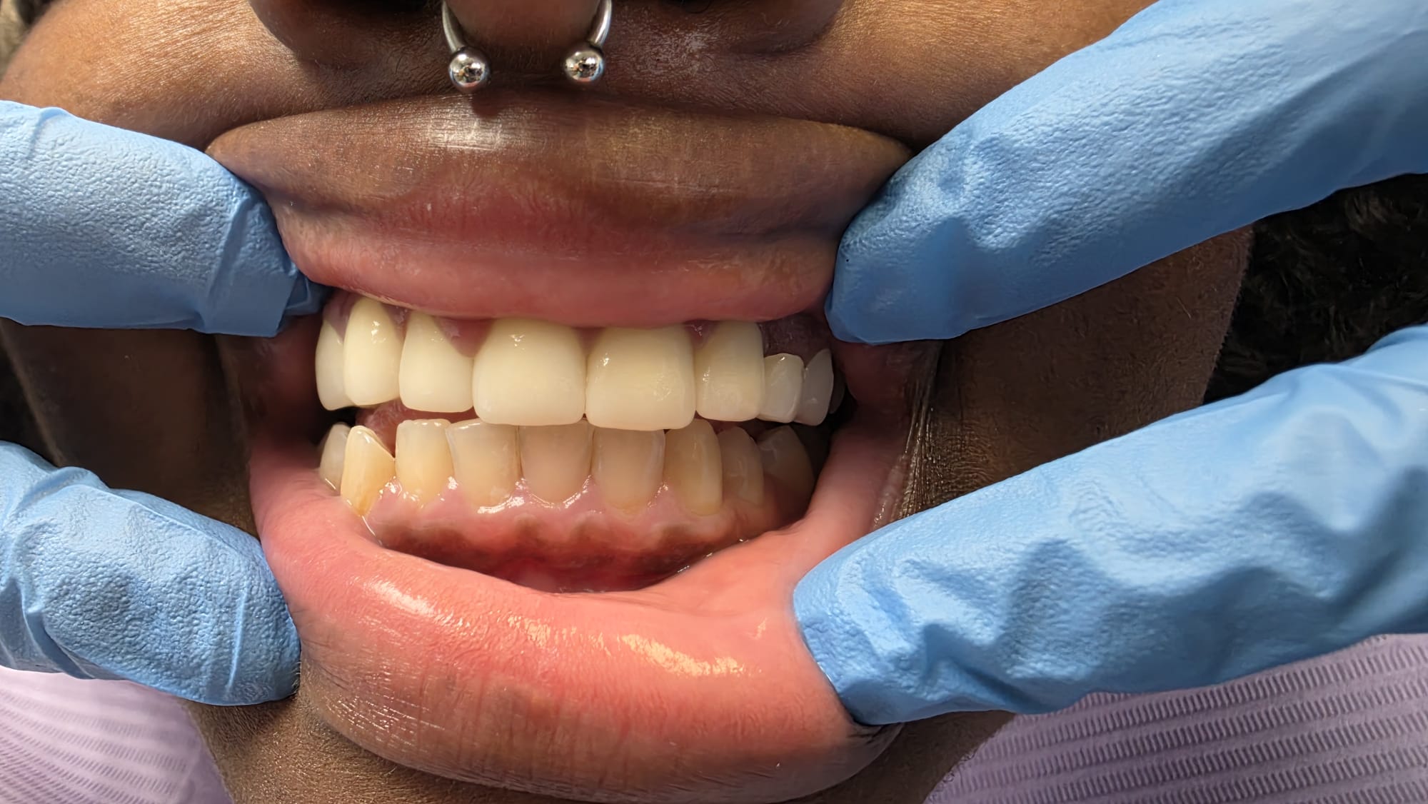 General & Periodontal Dentistry in Sea Girt, NJ | Deep Cleaning & Gum Care