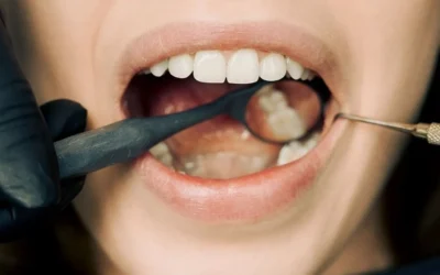 Why Seeing a Gum Cleaning Dentist in Sea Girt, NJ Early Makes a Big Difference?