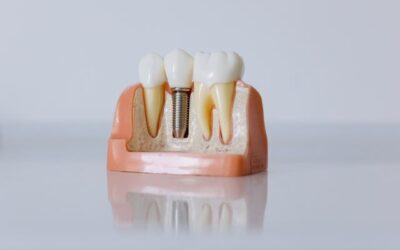 Stop Ignoring This: The First Sign of Gum Damage Most People Miss