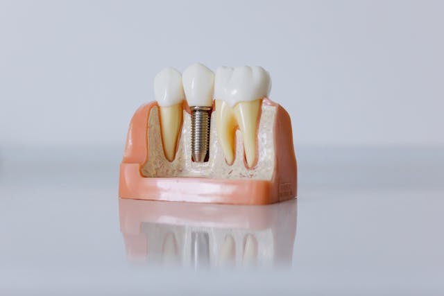 Stop Ignoring This: The First Sign of Gum Damage Most People Miss