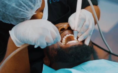 Dental Deep Root Cleaning in Sea Girt, NJ: Cost, Process & Benefits